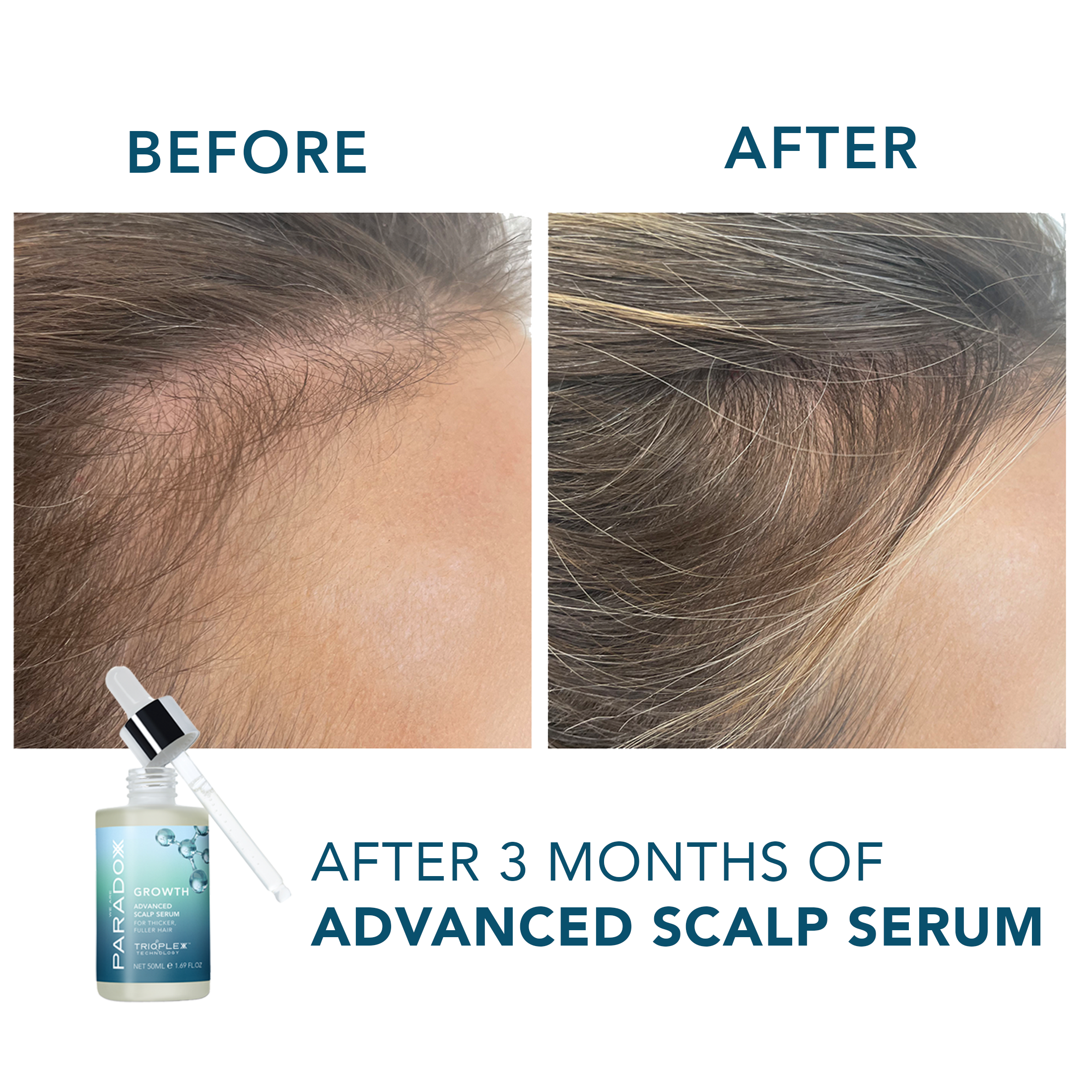 Advanced Scalp Serum